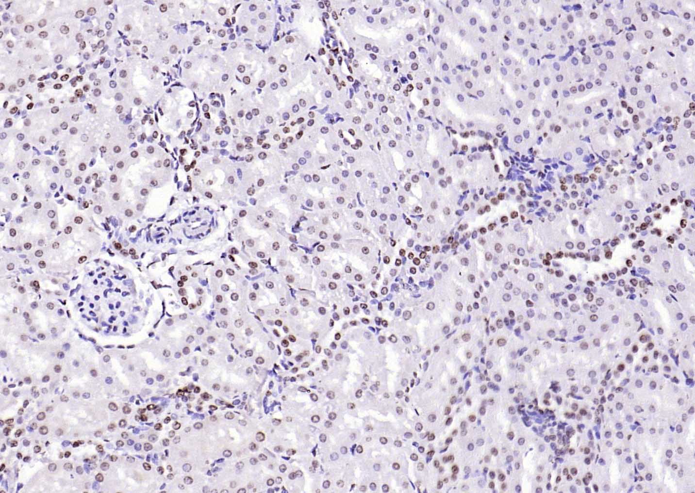 CENPA Rabbit pAb (一抗) - IHC-P,IHC-F,IF,ELISA | Bioss