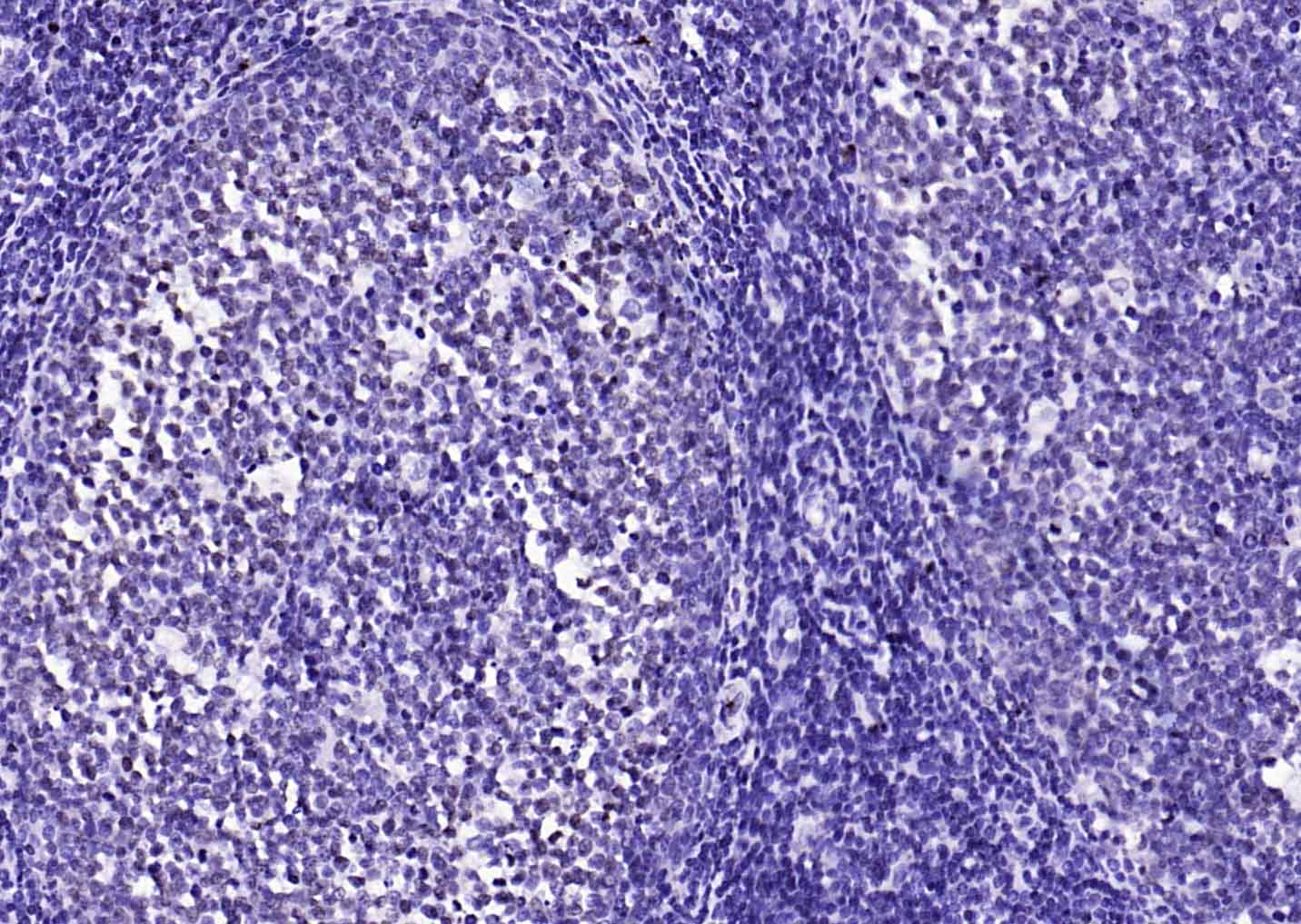 着丝粒蛋白A-bs-2753R