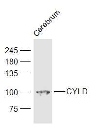 微管结合蛋白CYLD抗体-bs-2756R