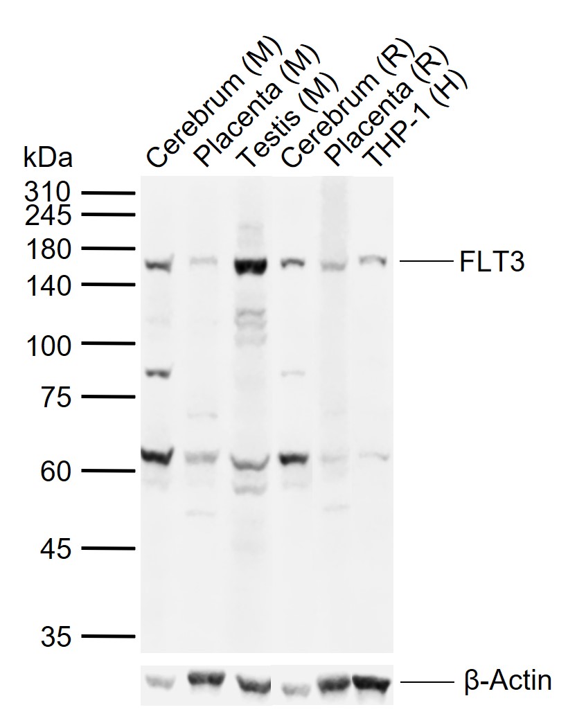 FLT3 Rabbit pAb (一抗) - WB,IHC-P,IHC-F,IF | Bioss