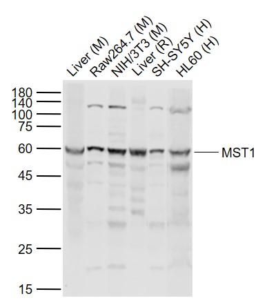 MST1 Rabbit pAb (一抗) - WB | Bioss