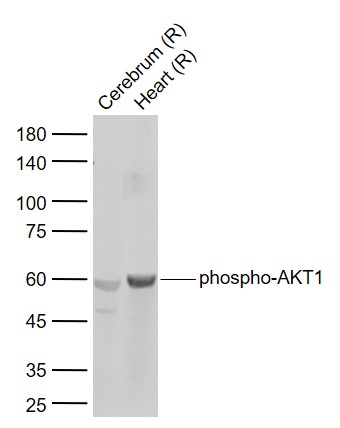 phospho-AKT1(Ser124) Rabbit pAb (一抗) | Bioss