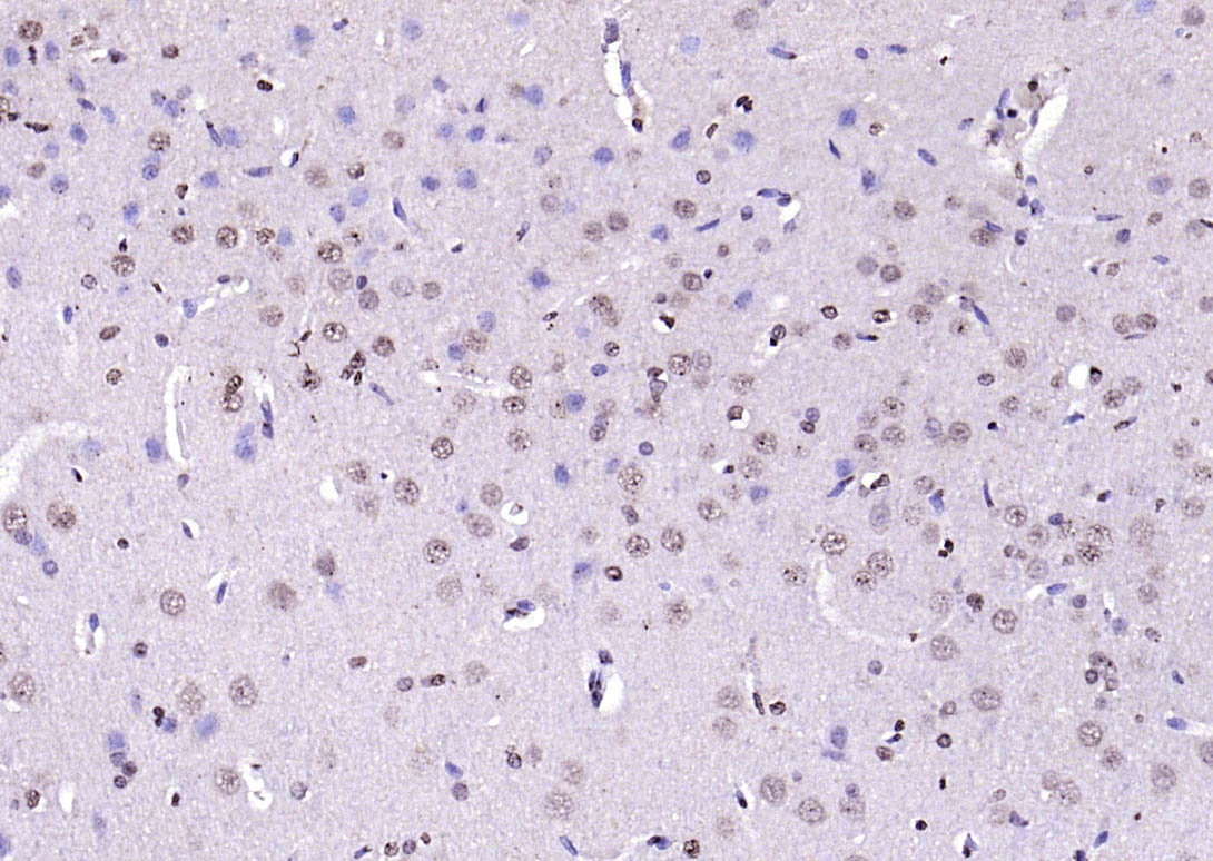 磷酸化蛋白激酶AKT1抗体-bs-2849R