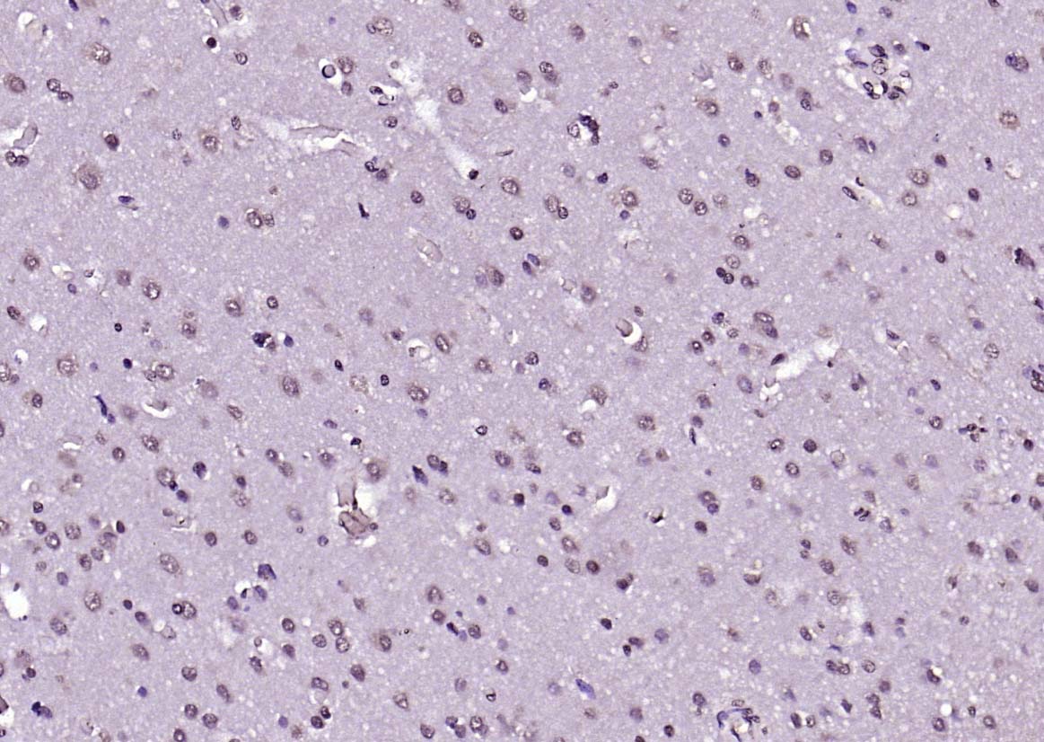 磷酸化蛋白激酶AKT1抗体-bs-2849R