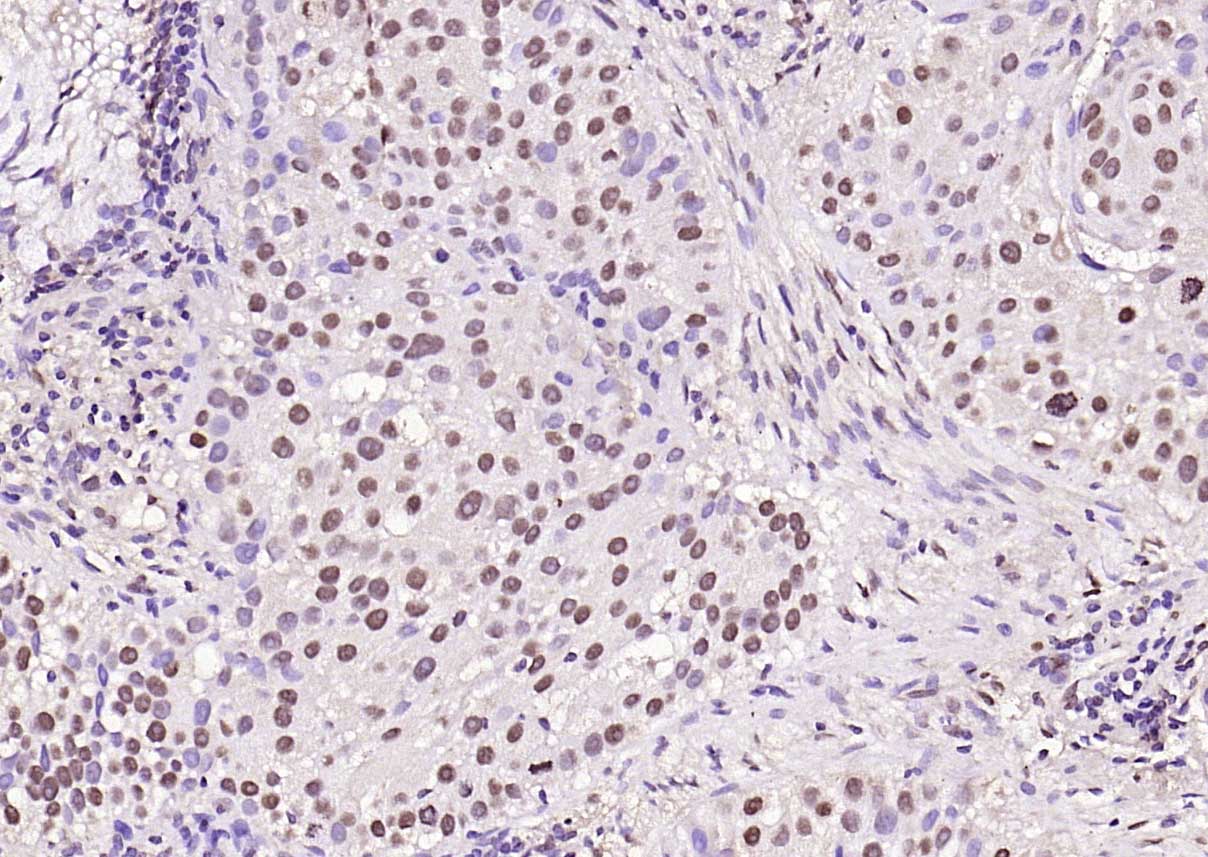 磷酸化蛋白激酶AKT1抗体-bs-2849R