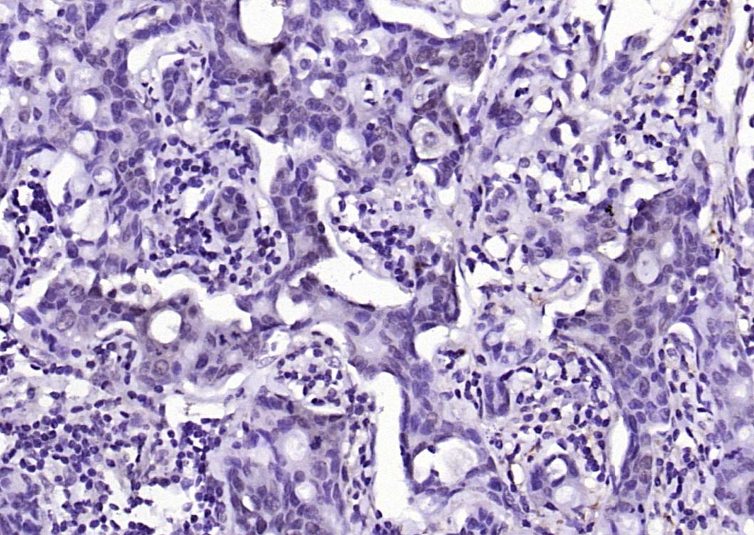 磷酸化蛋白激酶AKT1抗体-bs-2849R