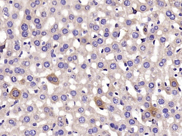 细胞色素P450 2C9抗体-bs-2887R