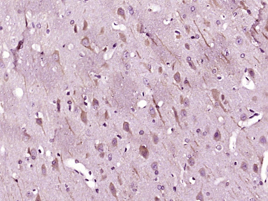 自噬微管相关蛋白轻链3抗体-bs-2912R