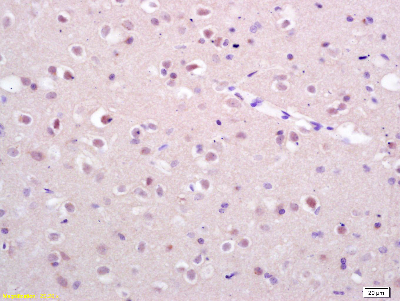 Exportin 1 Rabbit pAb (一抗) - IHC-P,IHC-F,IF | Bioss