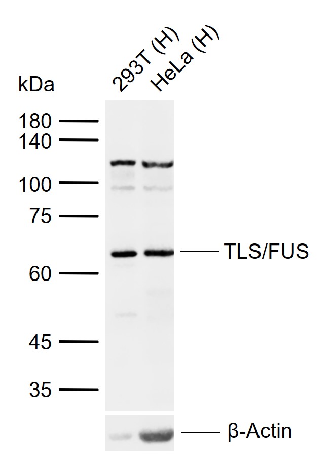 TLS/FUS Rabbit pAb (一抗) | Bioss
