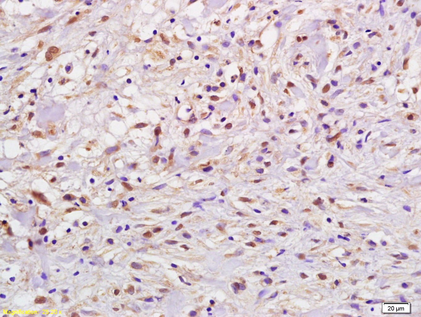 phospho-FANCD2 (Ser222) Rabbit pAb (一抗) | Bioss