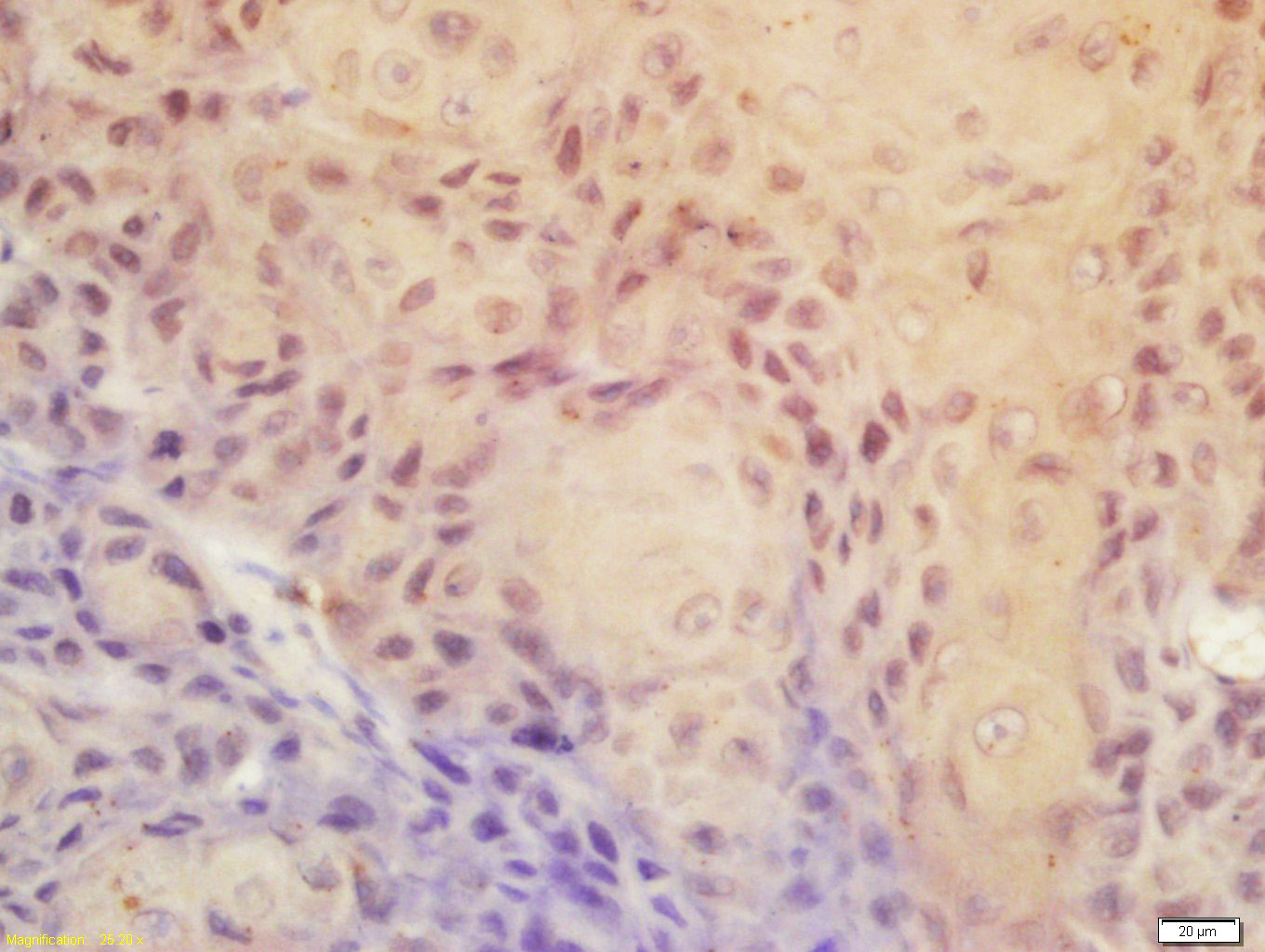 磷酸化周期素依赖性激酶9抗体-bs-3097R