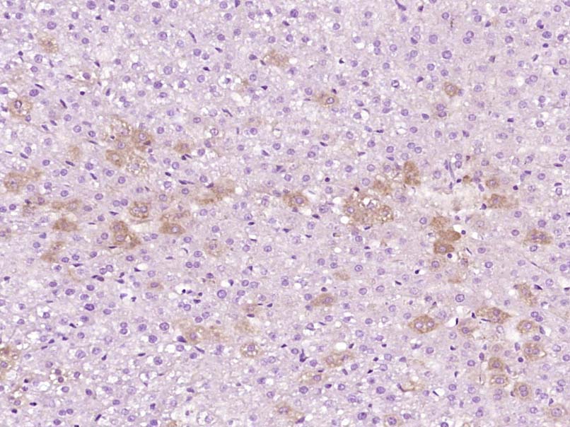 磷酸化丝切蛋白(Ser3)抗体-bs-3099R