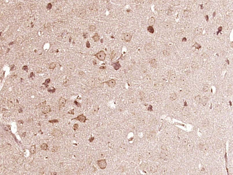 磷酸化丝切蛋白(Ser3)抗体-bs-3099R