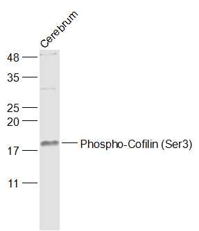 磷酸化丝切蛋白(Ser3)抗体-bs-3099R