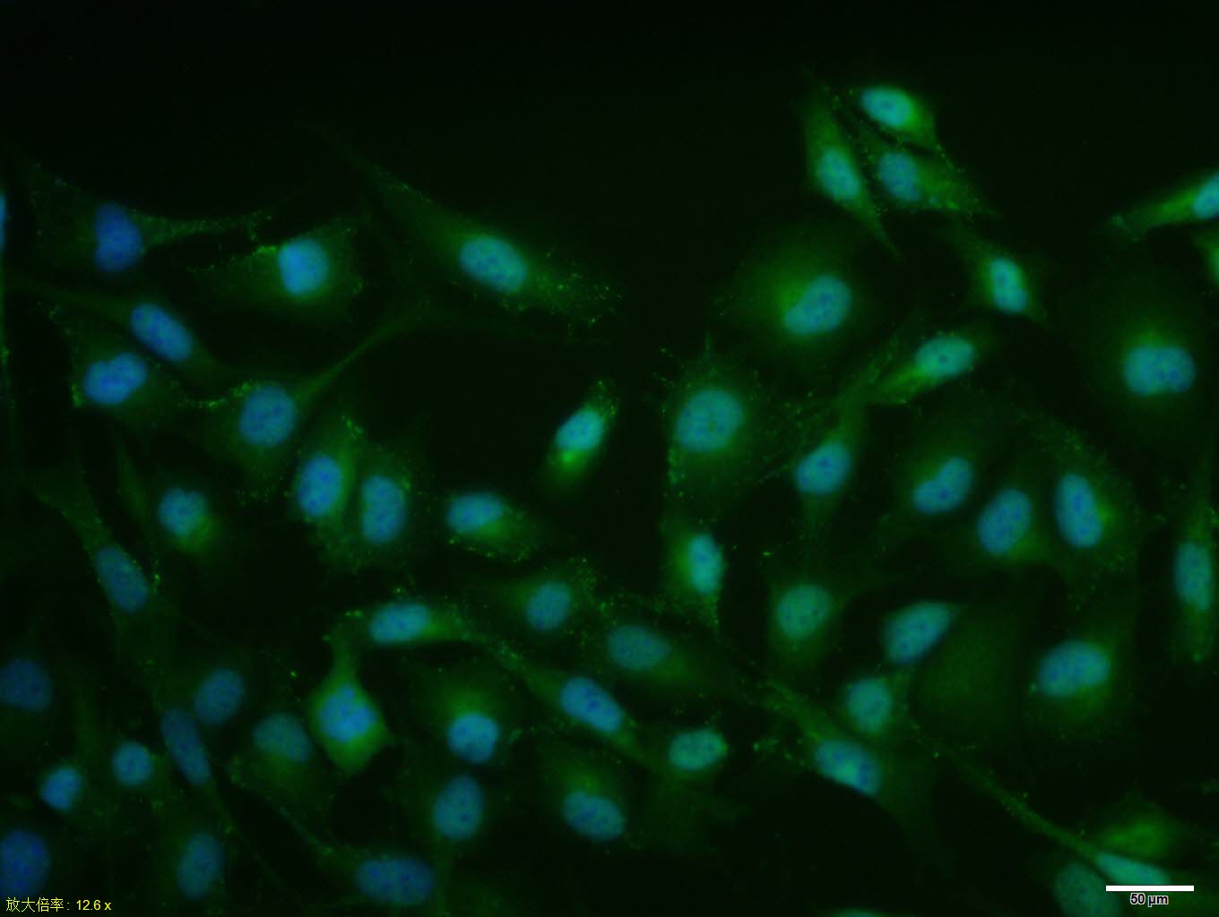 磷酸化雌激素受体α抗体-bs-3131R