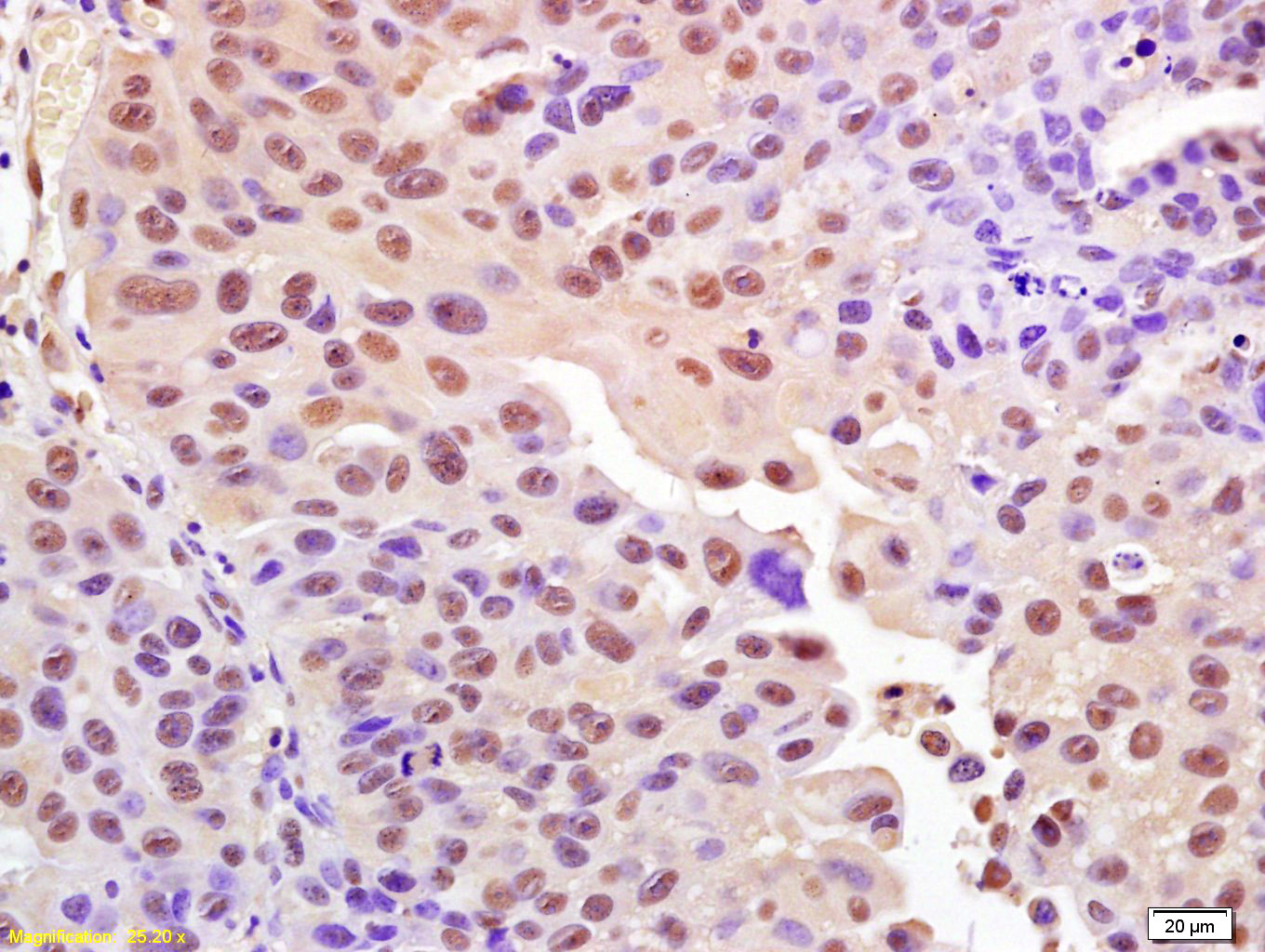 磷酸化组蛋白H2AX抗体-bs-3185R