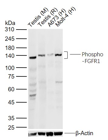 phospho-FGFR1 (Tyr653 + Tyr654) Rabbit pAb (一抗) | Bioss