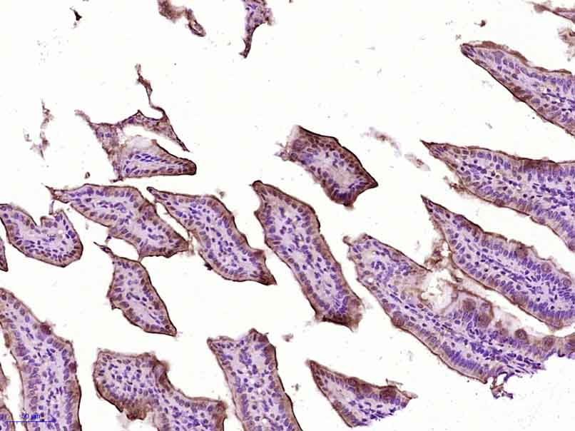 phospho-IKK alpha (Ser180) + IKK beta (Ser181) Rabbit pAb (一抗) - IHC-P,IHC-F,IF,Flow-Cyt,ICC/IF | Bioss