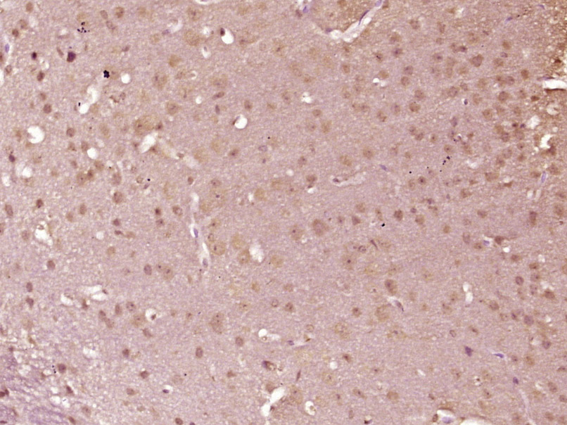 phospho-IKK alpha/beta (Ser176 + Ser180) Rabbit pAb (一抗) | Bioss
