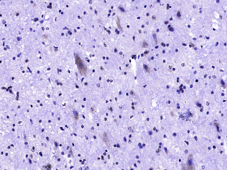phospho-c-Kit (Tyr721) Rabbit pAb (一抗) | Bioss