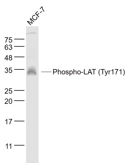 磷酸化T细胞活化连接蛋白抗体