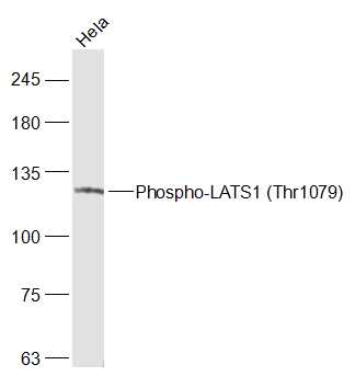 phospho-LATS1 (Thr1079) Rabbit pAb (一抗) | Bioss