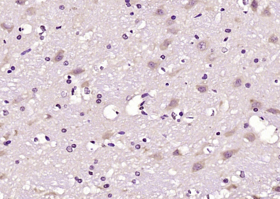 phospho-LATS1 (Ser909) Rabbit pAb (一抗) | Bioss