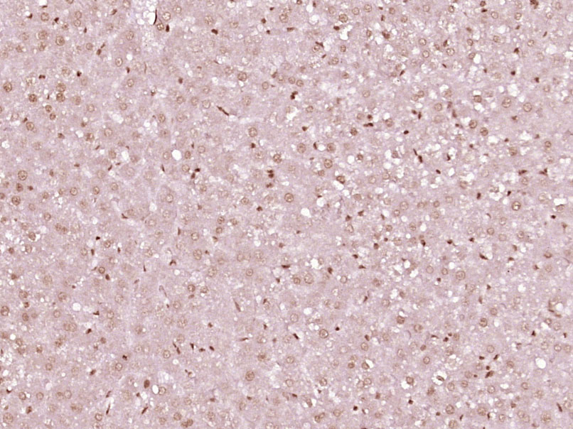 磷酸化丝氨酸/苏氨酸蛋白激酶抗体-bs-3248R