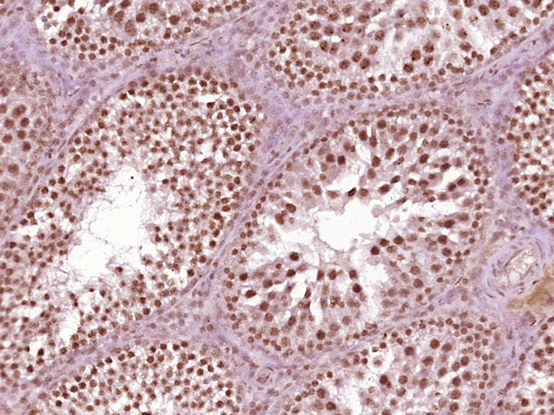 磷酸化丝氨酸/苏氨酸蛋白激酶抗体-bs-3248R