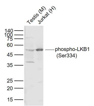 phospho-LKB1 (Ser334) Rabbit pAb (一抗) | Bioss