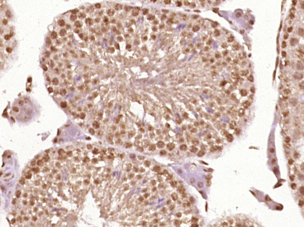 磷酸化丝氨酸/苏氨酸蛋白激酶抗体-bs-3249R