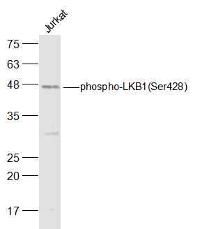 phospho-LKB1 (Ser428) Rabbit pAb (一抗) | Bioss