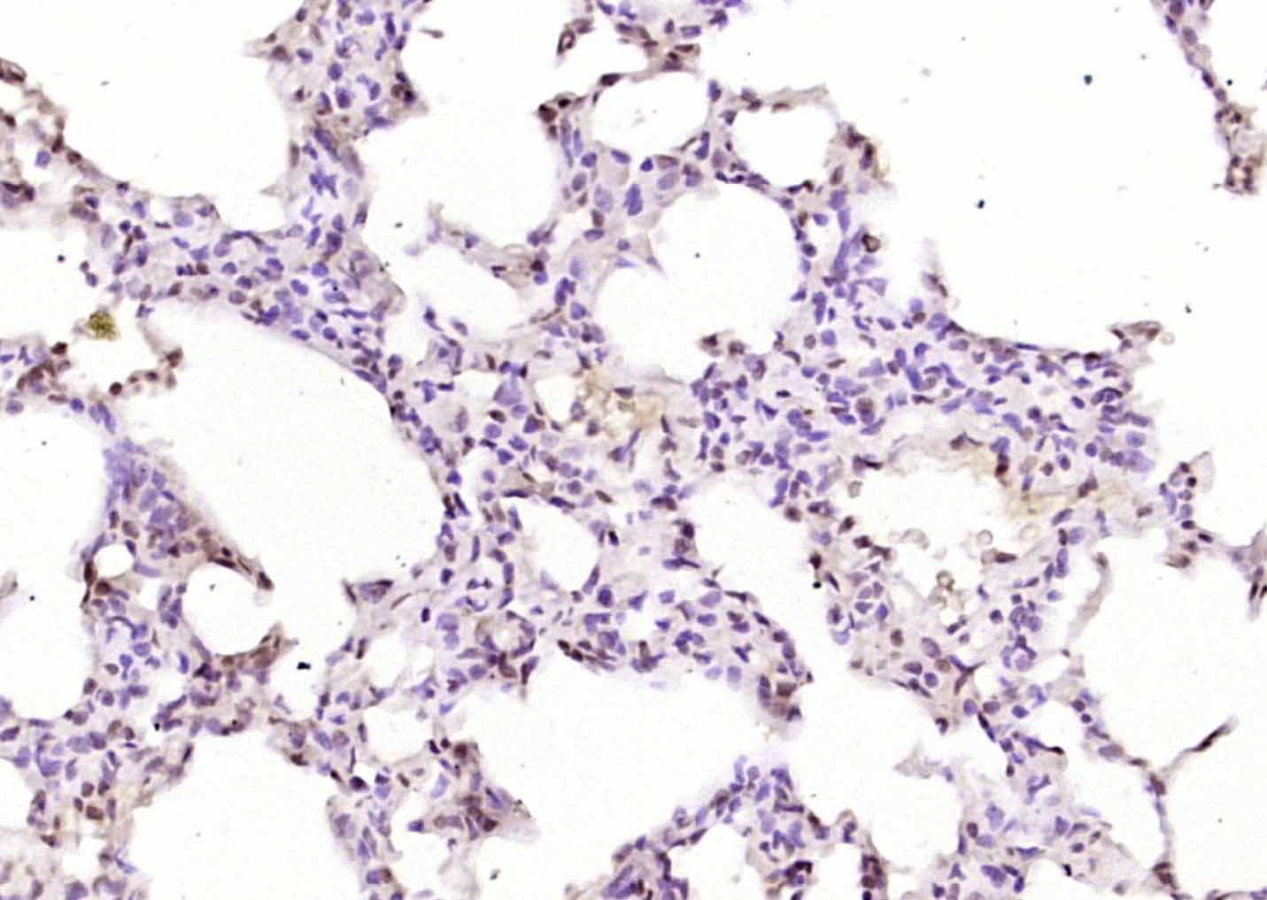 磷酸化膜相关蛋白酪氨酸激酶Lyn抗体-bs-3257R