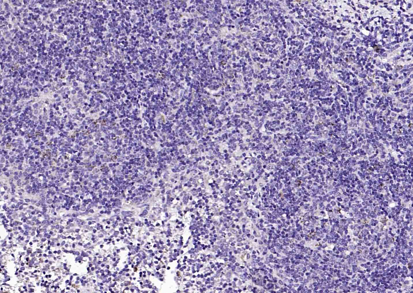 磷酸化膜相关蛋白酪氨酸激酶Lyn抗体-bs-3257R