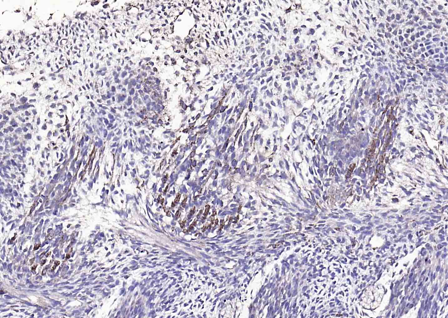 磷酸化膜相关蛋白酪氨酸激酶Lyn抗体-bs-3257R