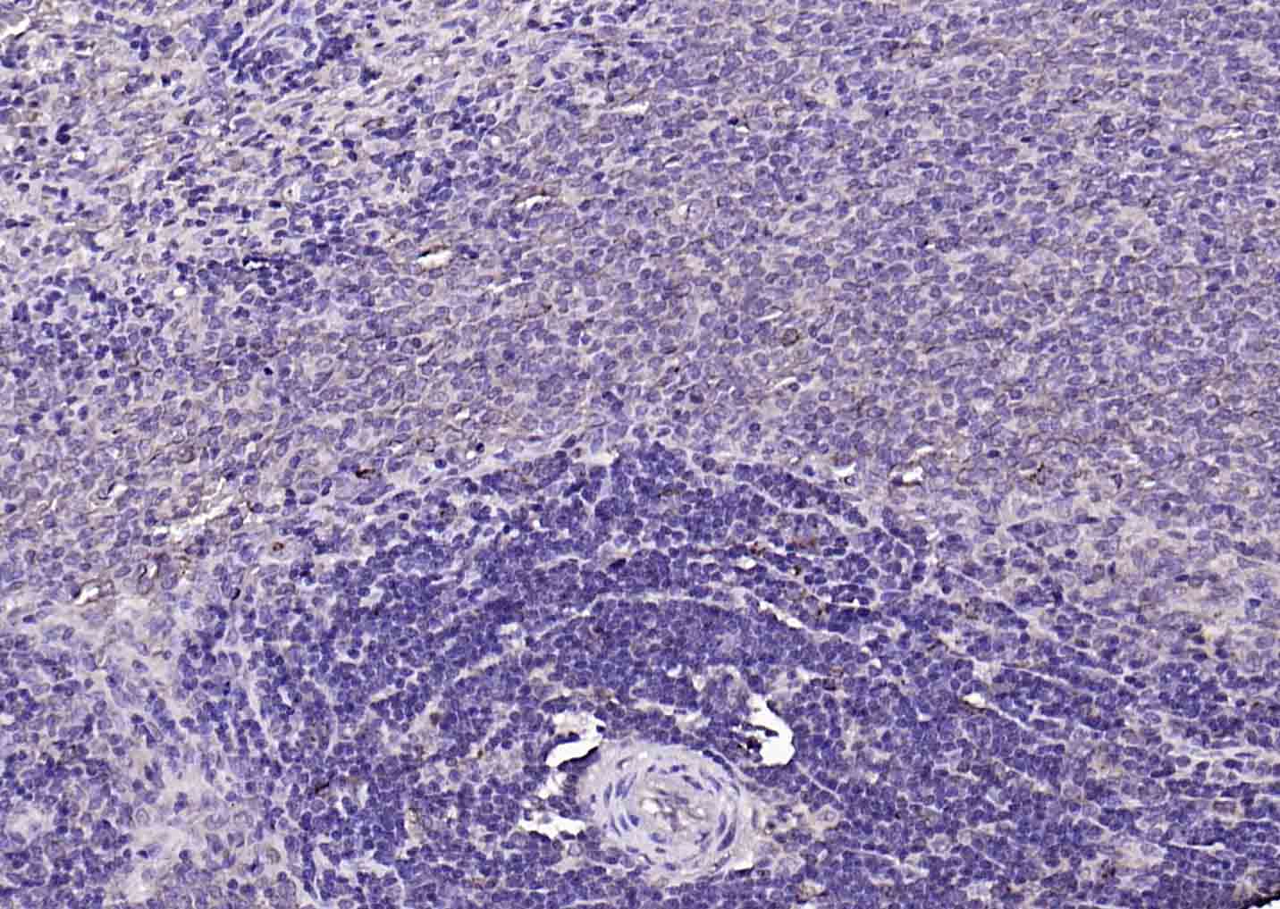 磷酸化膜相关蛋白酪氨酸激酶Lyn抗体-bs-3257R