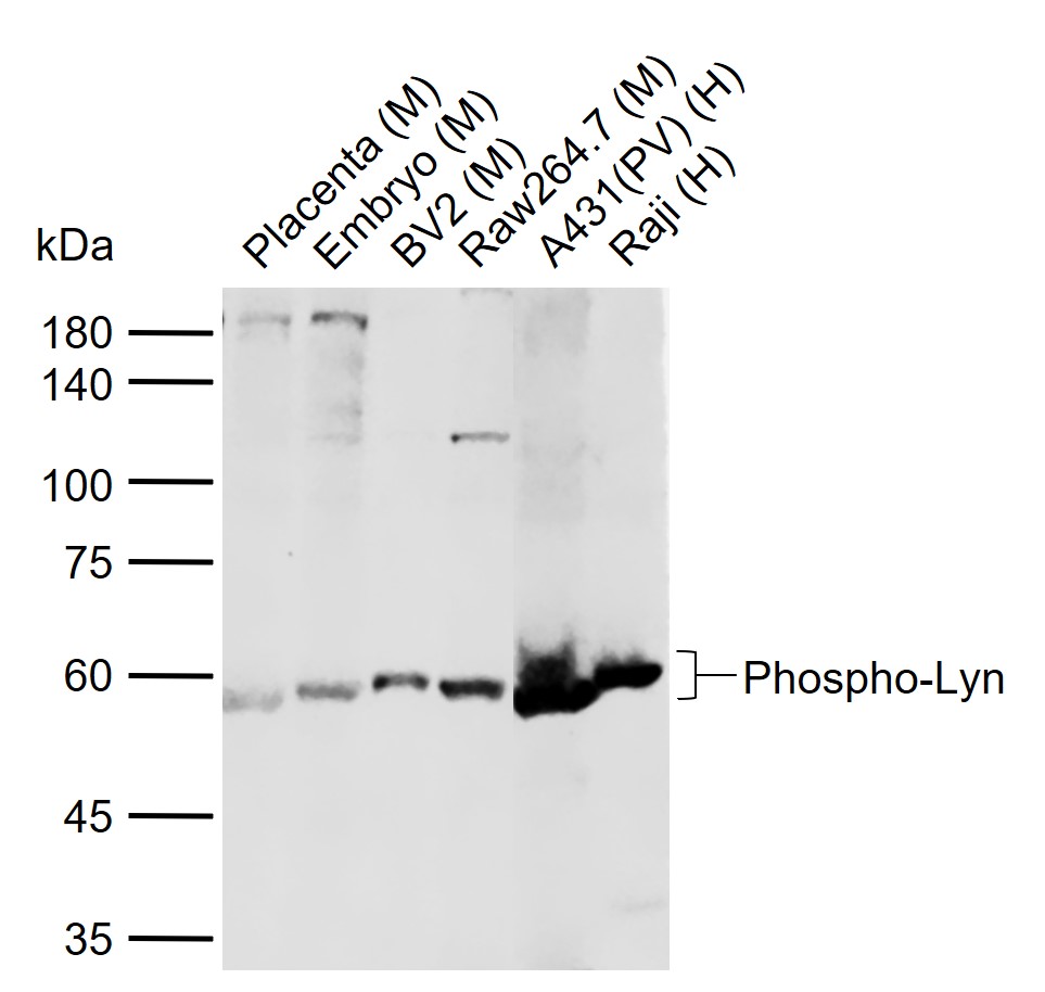 phospho-Lyn (Tyr397) Rabbit pAb (一抗) | Bioss