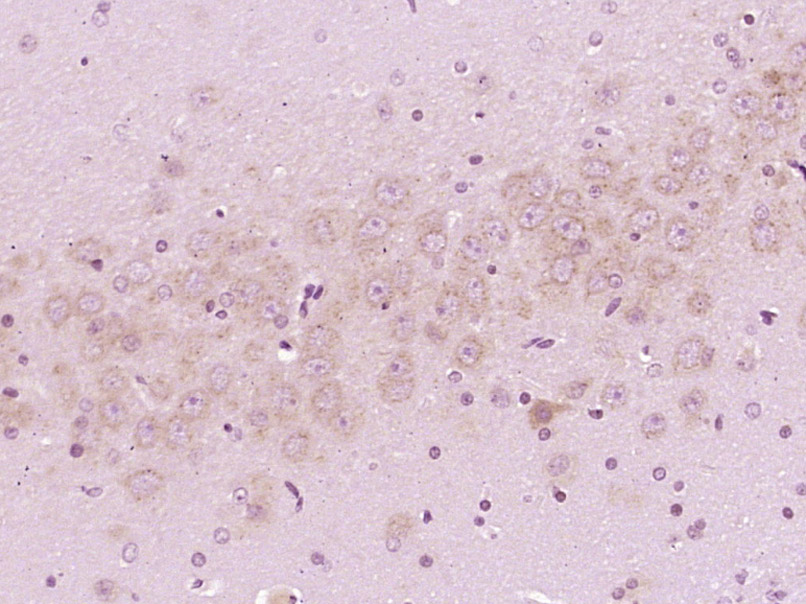 磷酸化丙氨酸蛋白激酶C底物Marcks抗体-bs-3263R