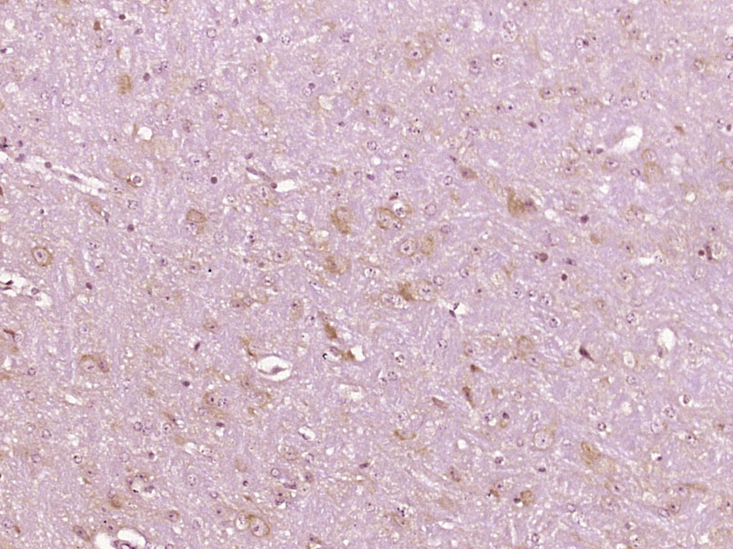磷酸化丙氨酸蛋白激酶C底物Marcks抗体-bs-3263R