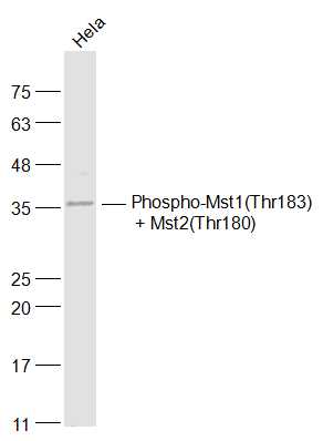 phospho-Mst1(Thr183) + Mst2(Thr180) Rabbit pAb (一抗) | Bioss