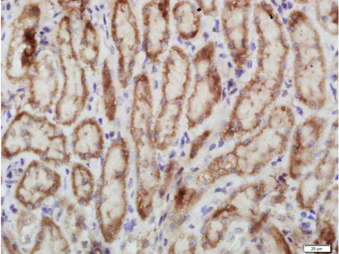 磷酸化蛋白激酶样内质网激酶抗体-bs-3330R