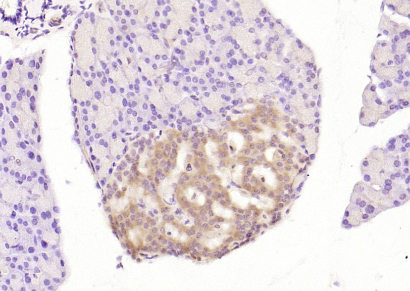 磷酸化蛋白激酶样内质网激酶抗体-bs-3330R