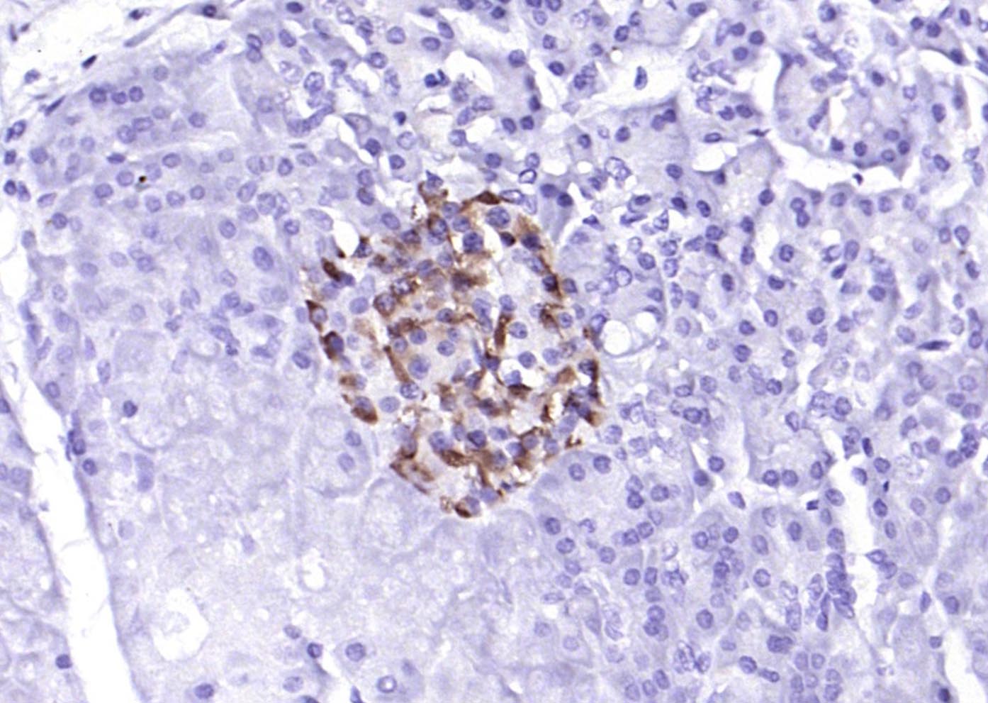 磷酸化蛋白激酶样内质网激酶抗体-bs-3330R