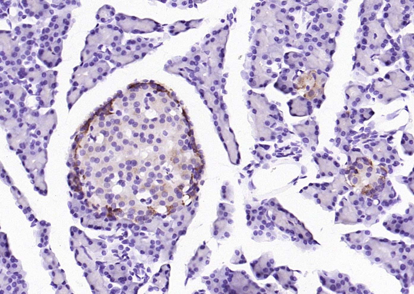 磷酸化蛋白激酶样内质网激酶抗体-bs-3330R