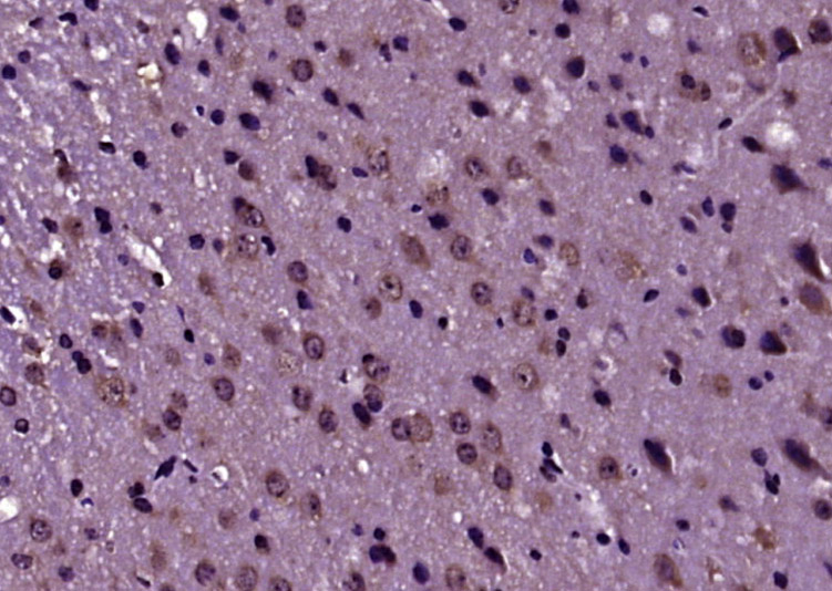 磷酸化mTOR相关调控蛋白抗体-bs-3381R