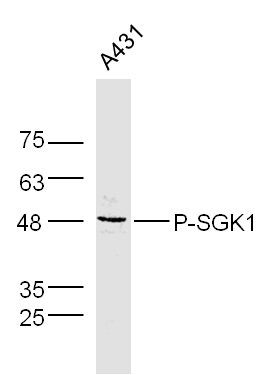 phospho-SGK1 (Ser78) Rabbit pAb (一抗) - WB,IHC-P,IHC-F,IF | Bioss