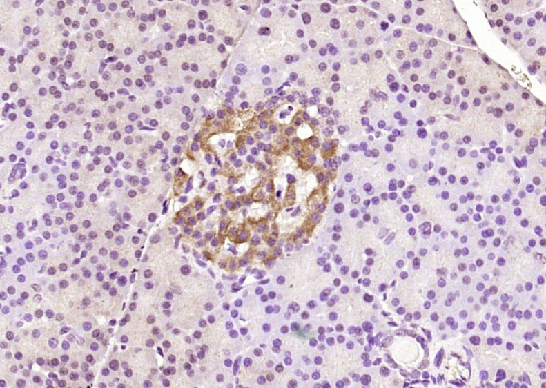 磷酸化糖皮质激素调节激酶1抗体-bs-3395R