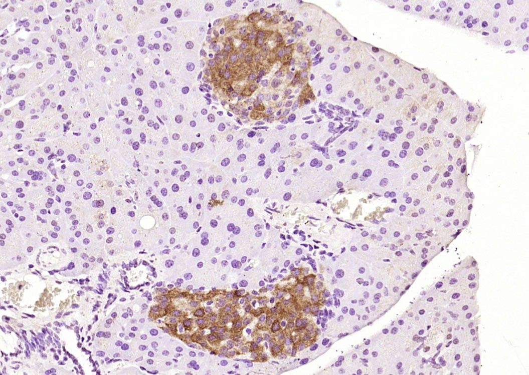 磷酸化糖皮质激素调节激酶1抗体-bs-3395R