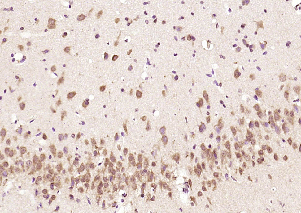 磷酸化糖皮质激素调节激酶1抗体-bs-3395R